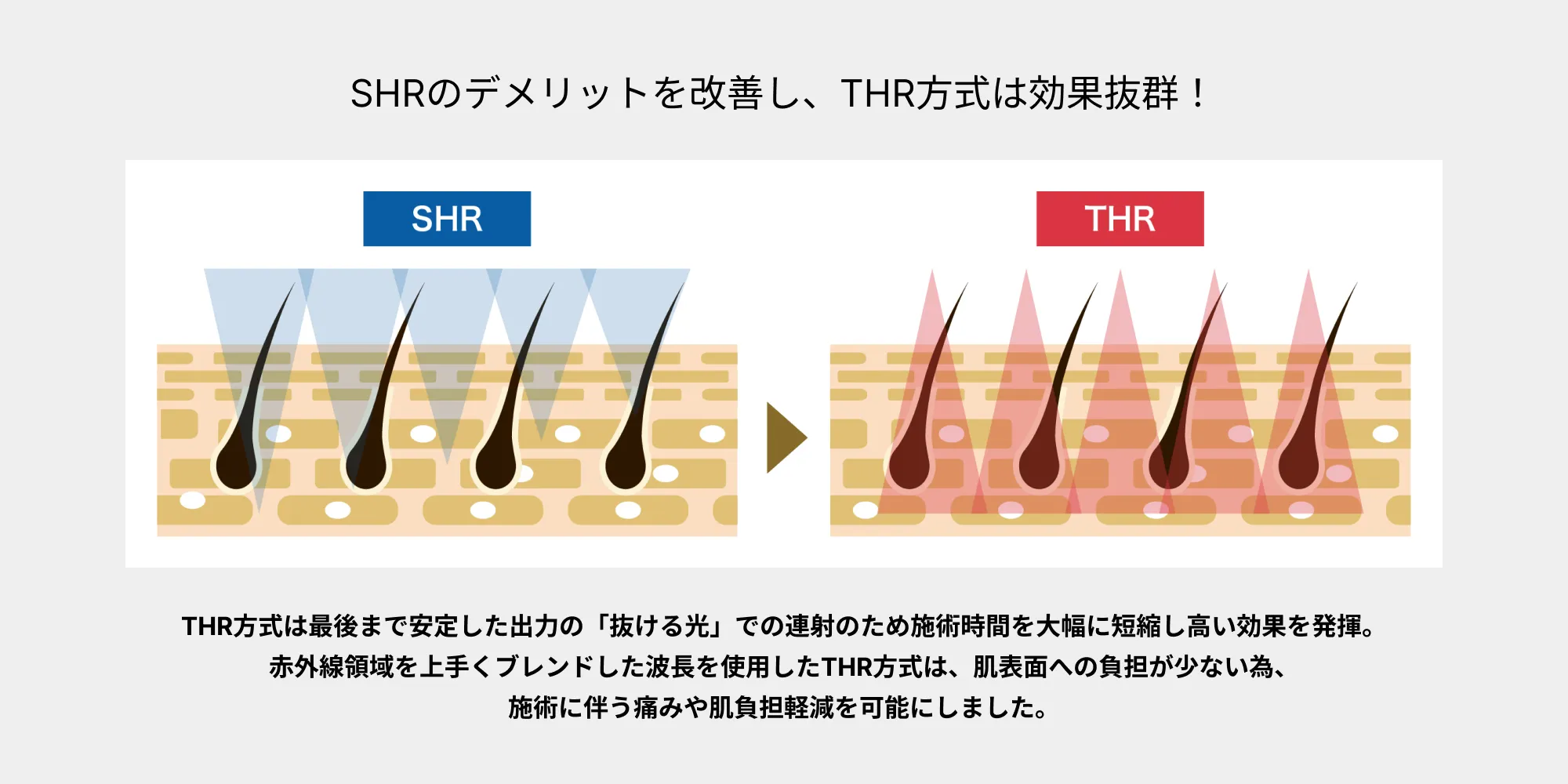 SHR方式とTHR方式の違い